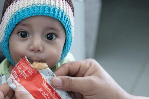 112 þúsund börn undir fimm ára hafa fengið lífsnauðsynlega meðhöndlun við vannæringu í Jemen á þessu ári. Ljósmynd: UNICEF