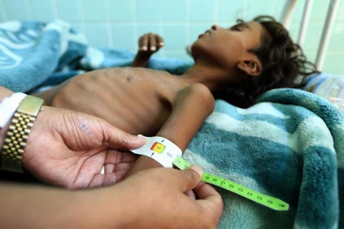 Ljósmynd: UNICEF/ Huwais