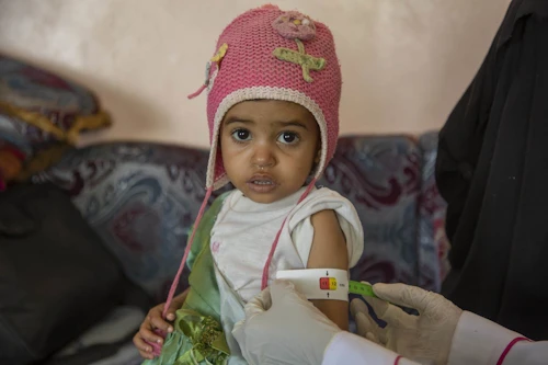 Ljósmynd: UNICEF/Almahbashi