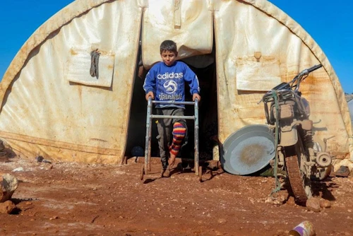 Átta ára drengur í Idlib, Sýrlandi sem slasaðist á fæti og maga í sprengjuárás á húsið hans. Fjölskylda hans lagðist á flótta eftir árásina og býr núna í flóttamannabúðum í Idlib. Ljósmynd: Save the Children