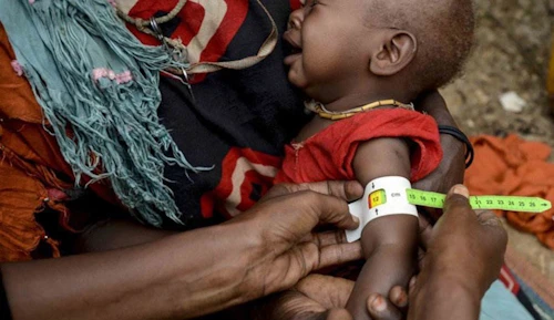 Ljósmynd: UNICEF/Rich